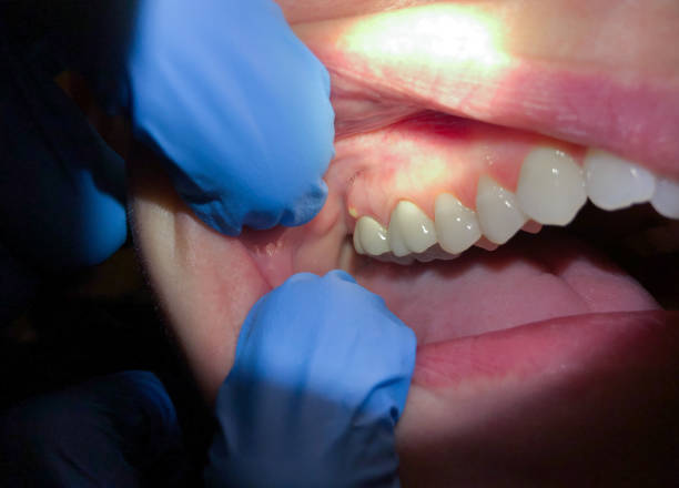 Best Walk-In Emergency Dental Services in Baxter Springs, KS